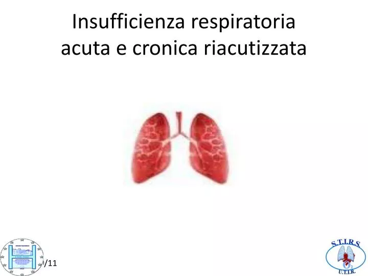 insufficienza respiratoria acuta e cronica riacutizzata
