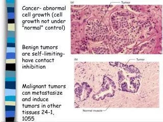 Cancer- abnormal cell growth (cell growth not under &quot;normal&quot; control)