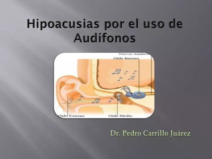 hipoacusias por el uso de aud fonos