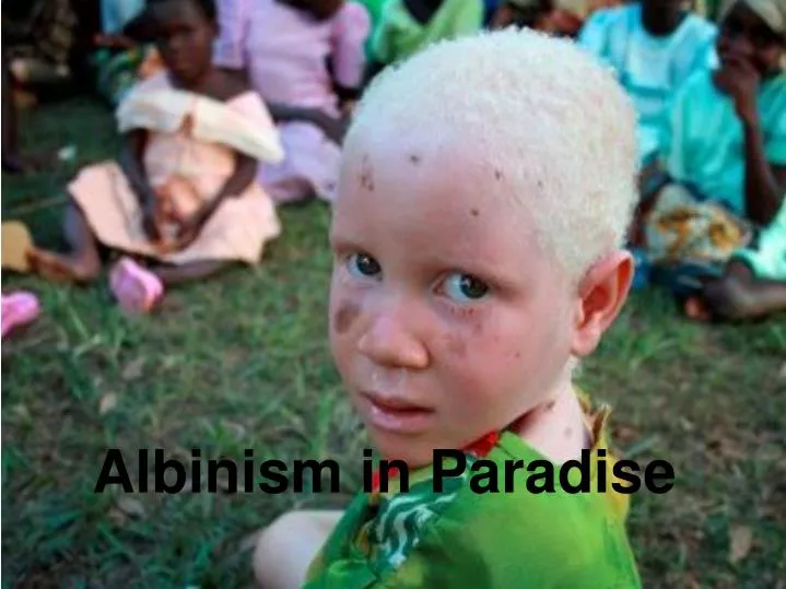 albinism in paradise