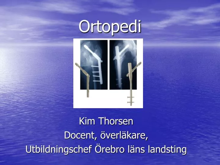 ortopedi