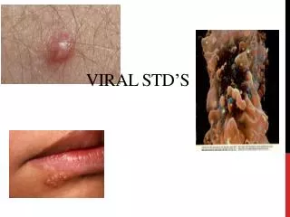 viral std s