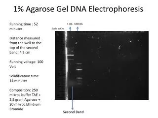 1% Agarose Gel DNA Electrophoresis