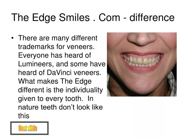 the edge smiles com difference