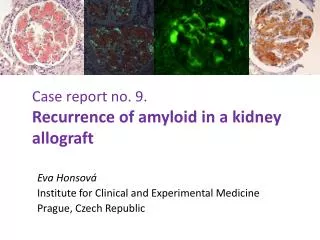 Case report no. 9. Recurrence of amyloid in a kidney allograft