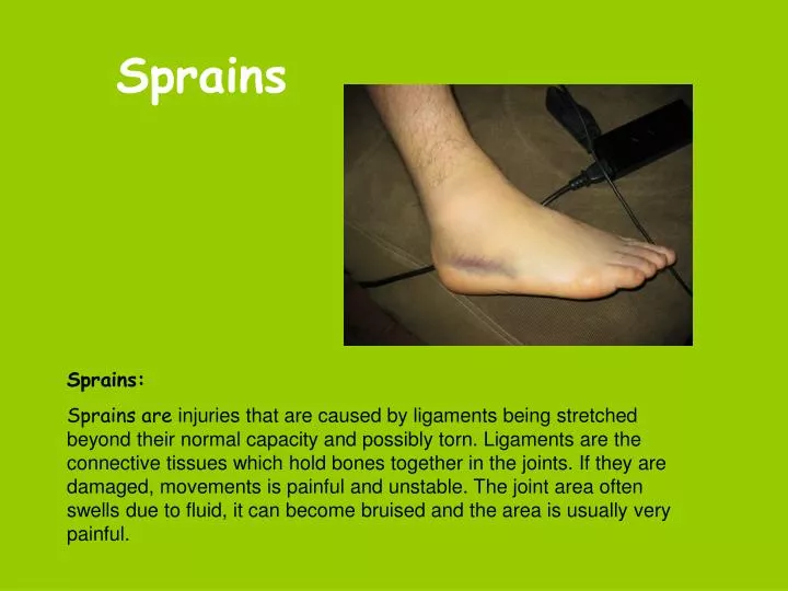 sprains