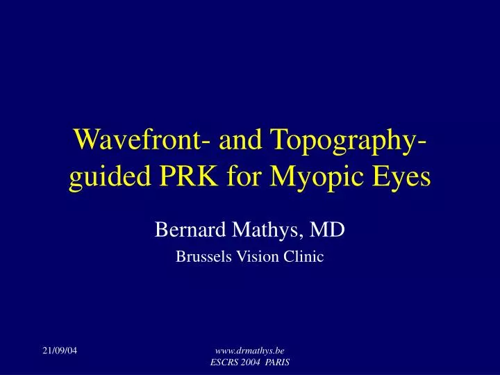 wavefront and topography guided prk for myopic eyes