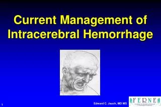 Current Management of Intracerebral Hemorrhage