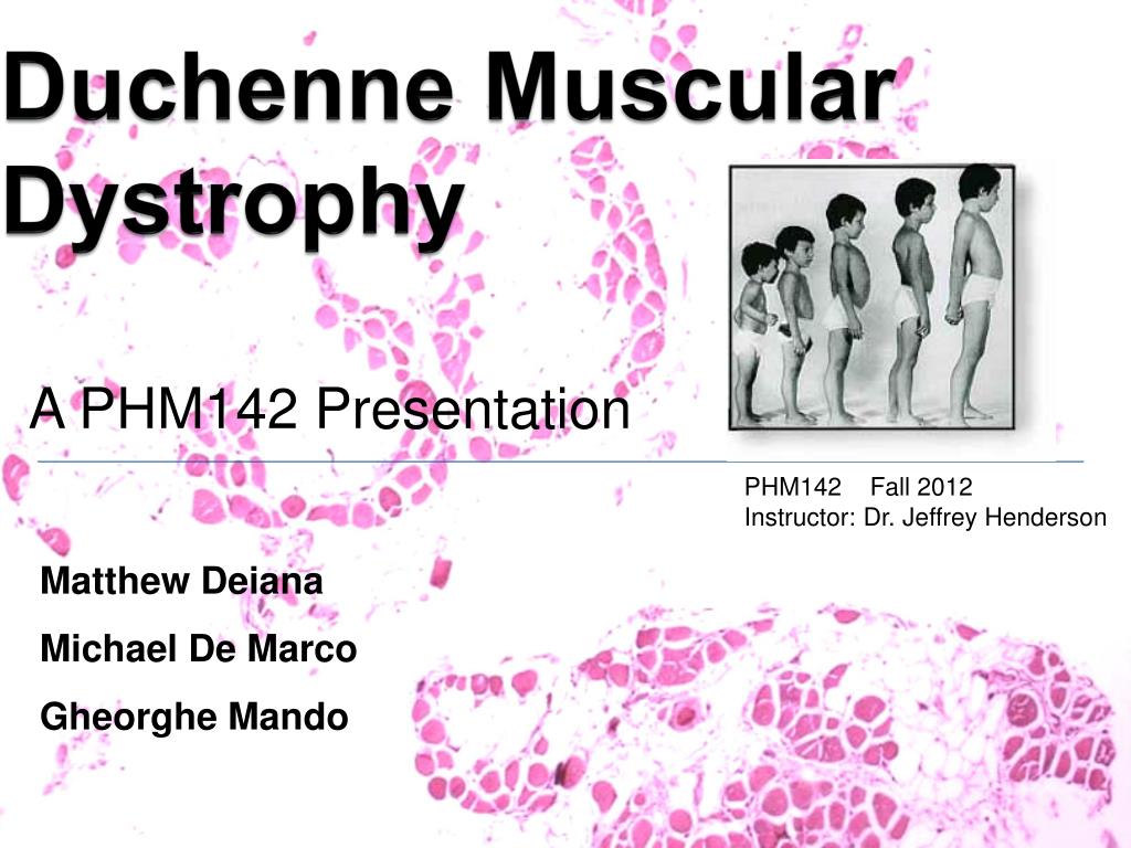 PPT - Duchenne Muscular Dystrophy PowerPoint Presentation, free ...