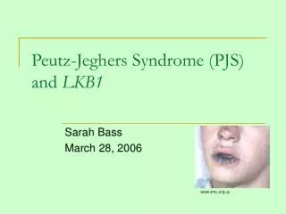 Peutz-Jeghers Syndrome (PJS) and LKB1