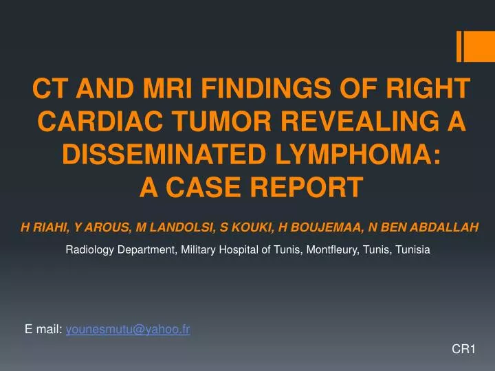 ct and mri findings of right cardiac tumor revealing a disseminated lymphoma a case report