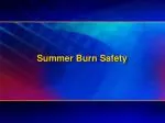 Summer Burn Safety - slide 1