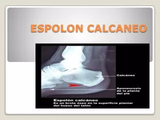 ESPOLON CALCANEO