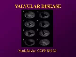 VALVULAR DISEASE