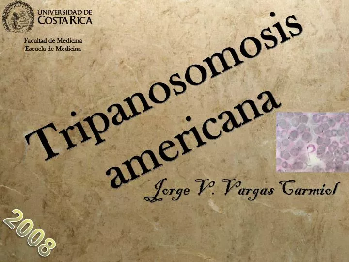 tripanosomosis americana
