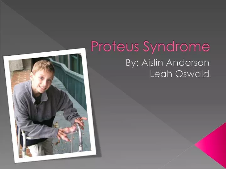 proteus syndrome