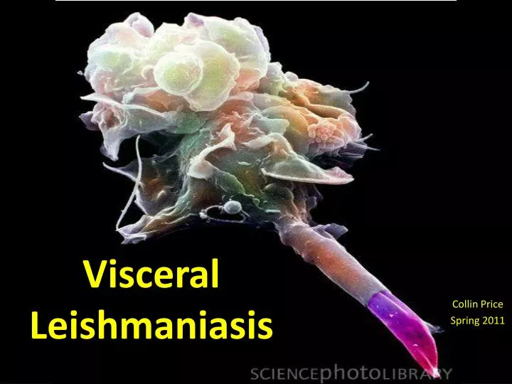 visceral leishmaniasis