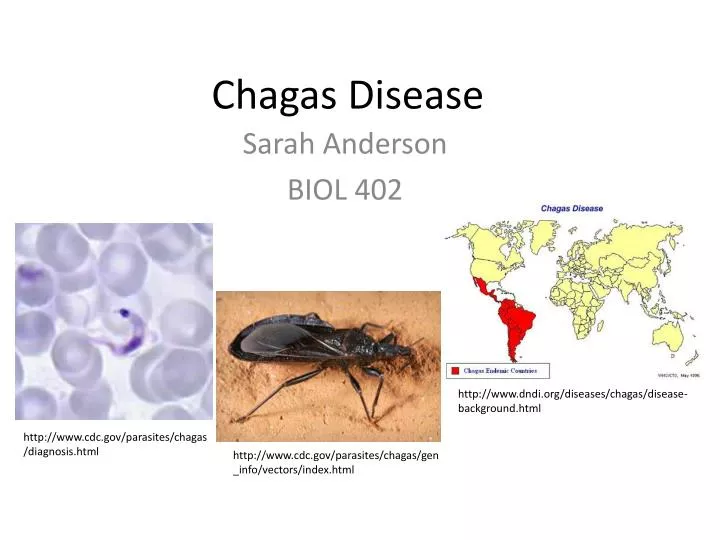 chagas disease