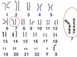 Look at the spread of human chromosomes (Called Karyotype):