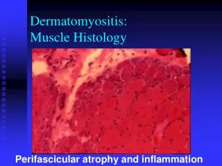 Dermatomyositis: Muscle Histology