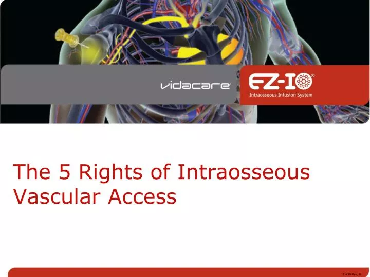 the 5 rights of intraosseous vascular access