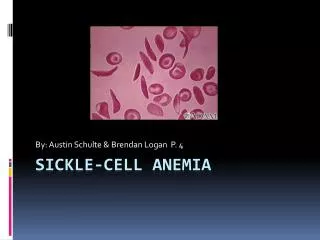 sickle-cell Anemia
