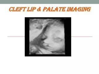 Cleft Lip &amp; Palate imaging