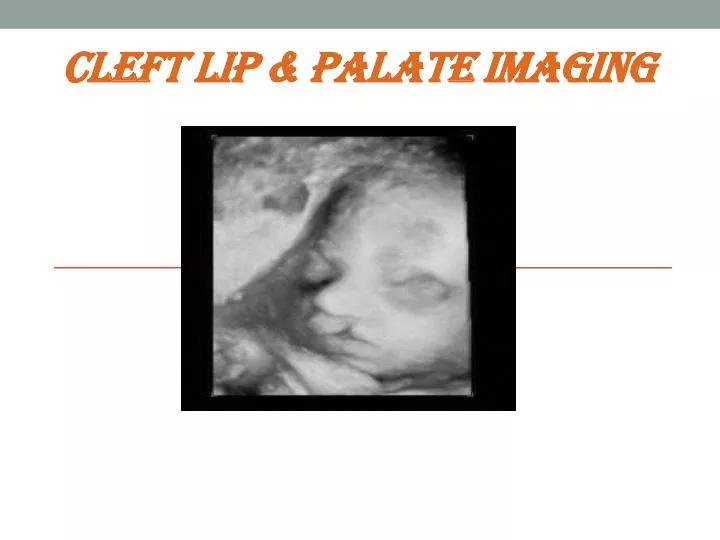 cleft lip palate imaging