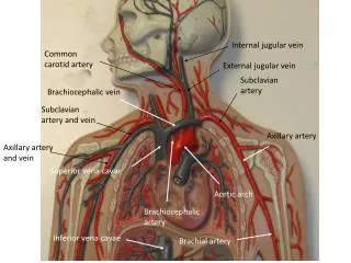 Aortic arch