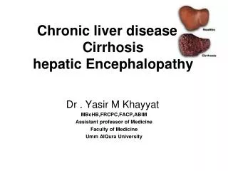 Chronic liver disease Cirrhosis hepatic Encephalopathy