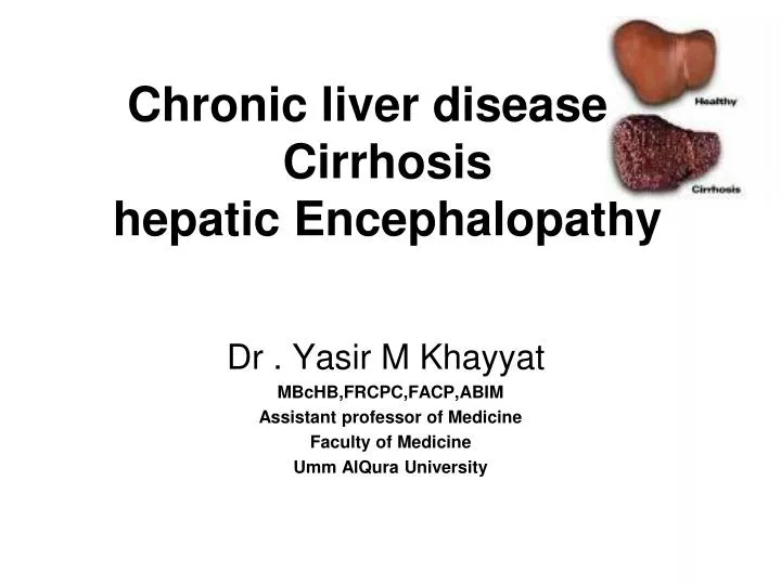 chronic liver disease cirrhosis hepatic encephalopathy