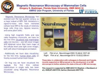 Left : Flint et al. , NeuroImage 2009 15;46(4):1037-40