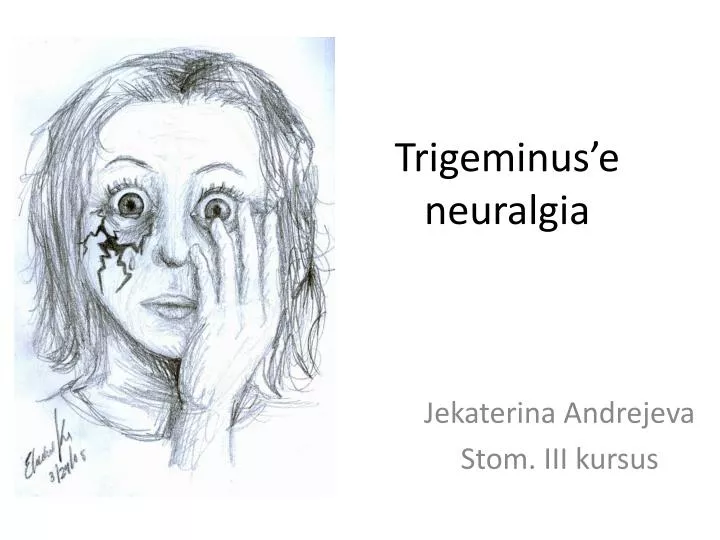 trigeminus e neuralgia