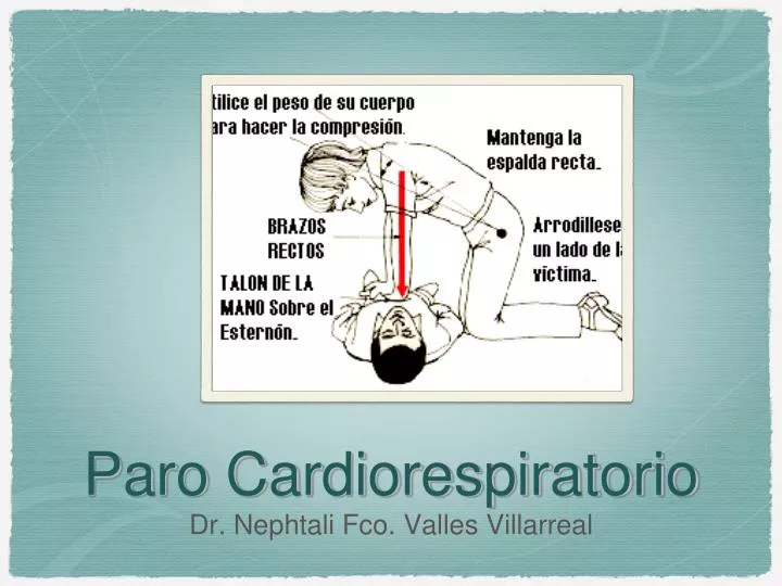 paro cardiorespiratorio