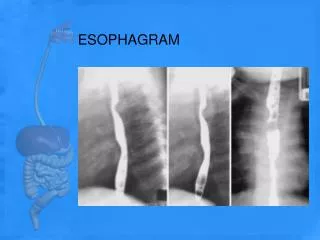 ESOPHAGRAM