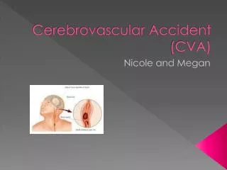 cerebrovascular accident cva