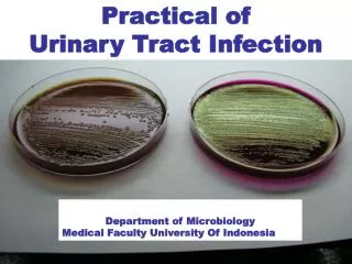 Practical of Urinary Tract Infection