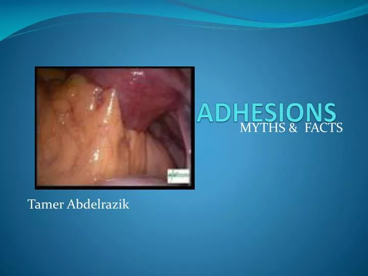 adhesions