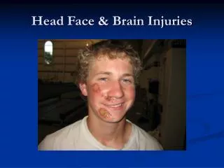 Head Face &amp; Brain Injuries