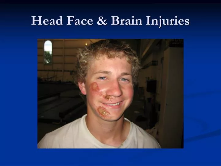 head face brain injuries