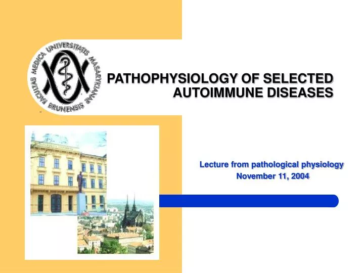 pathophysiology of selected autoimmune diseases