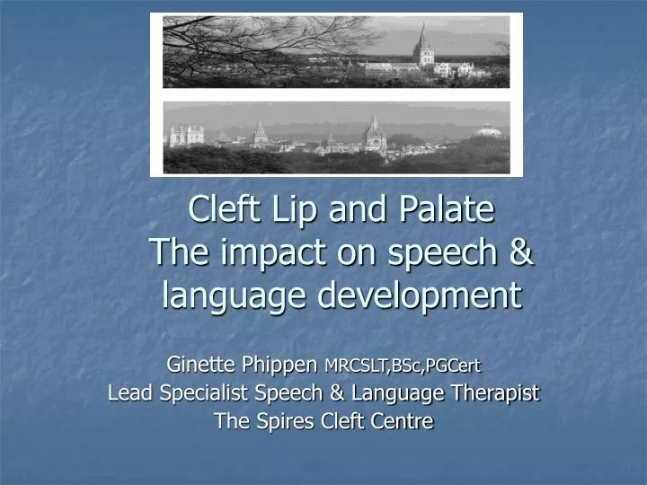cleft lip and palate the impact on speech language development