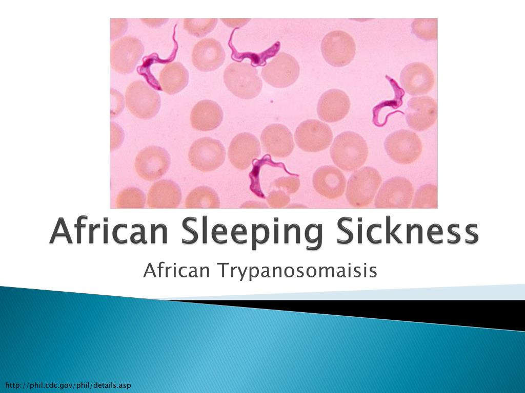 PPT - African Sleeping Sickness PowerPoint Presentation, free download ...