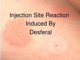 Injection Site Reaction