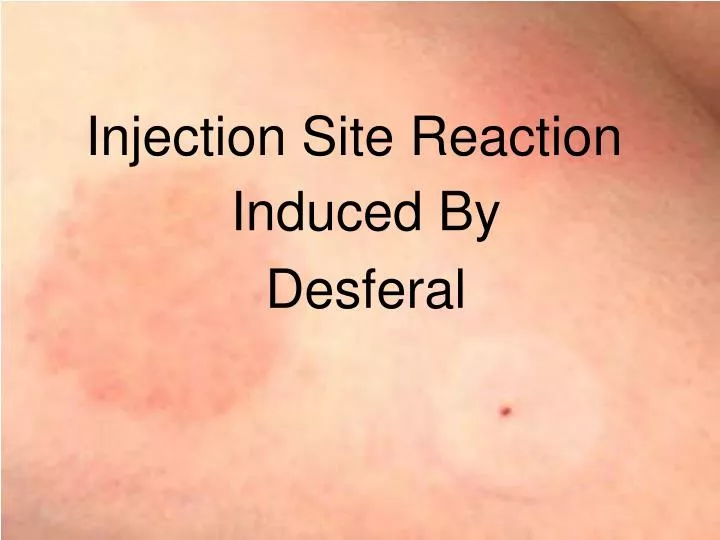 injection site reaction