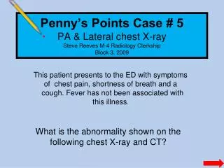 penny s points case 5 pa lateral chest x ray steve reeves m 4 radiology clerkship block 3 2009