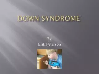 Down syndrome