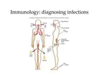 Immunology: diagnosing infections