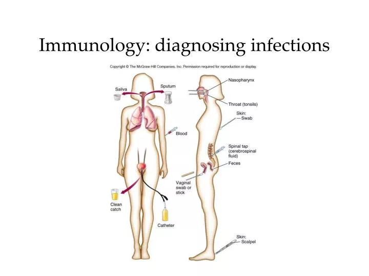 immunology diagnosing infections