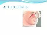 ALLERGIC RHINITIS - slide 1